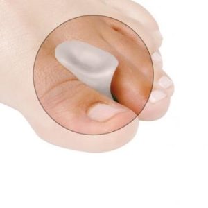 GelSmart Licht Corrigerende Teenspreider Small, 3 st.