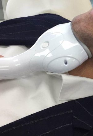 Kin handstuk voor Cryo-Lipo Only 4.0