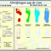 Poster afwijkingen van de voet 40 x 60, geplastificeerd